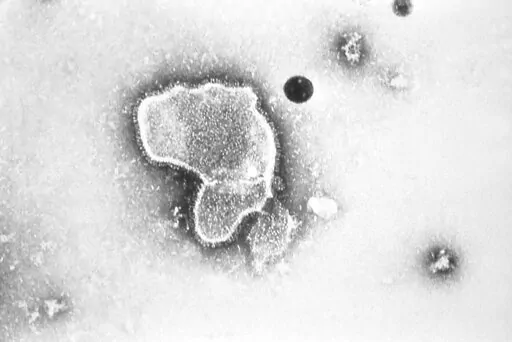 This 1981 photo provided by the Centers for Disease Control and Prevention (CDC) shows an electron micrograph of Respiratory Syncytial Virus, also known as RSV. Children's hospitals in parts of the country are seeing a distressing surge in RSV, a common respiratory illness that can cause severe breathing problems for babies. Cases fell dramatically two years ago as the pandemic shut down schools, day cares and businesses. Then, with restrictions easing, the summer of 2021 brought an alarming inc
