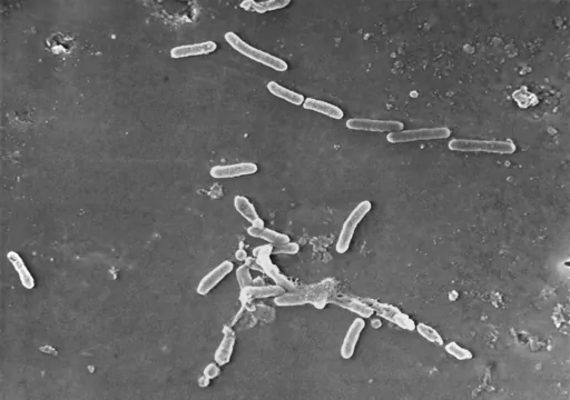 This scanning electron microscope image made available by the Centers for Disease Control and Prevention shows rod-shaped Pseudomonas aeruginosa bacteria. U.S. officials are reporting two more deaths and additional cases of vision loss linked to eyedrops tainted with the drug-resistant bacteria. The eyedrops from EzriCare and Delsam Phama were recalled in February 2023 and health authorities are continuing to track infections as they investigate the outbreak. (Janice Haney Carr/Centers for Disea