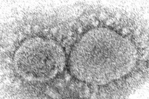 This 2020 electron microscope image made available by the Centers for Disease Control and Prevention shows SARS-CoV-2 virus particles, which cause COVID-19. The House voted unanimously Friday, March 10, 2023, to declassify U.S. intelligence information about the origins of COVID-19, a sweeping show of bipartisan support near the third anniversary of the start of the deadly pandemic. (Hannah A. Bullock, Azaibi Tamin/CDC via AP, File)