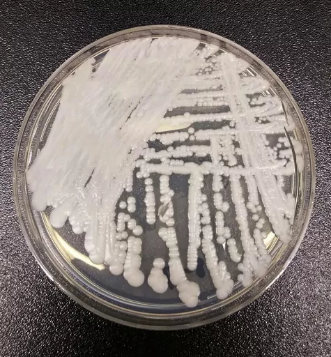 This undated photo made available by the Centers for Disease Control and Prevention shows a strain of Candida auris cultured in a petri dish at a CDC laboratory. In a CDC paper published by the Annals of Internal Medicine on Monday, March 20, 2023, U.S. cases of the dangerous fungus tripled over just three years, and more than half of states have now reported it. (Shawn Lockhart/Centers for Disease Control and Prevention via AP, File)