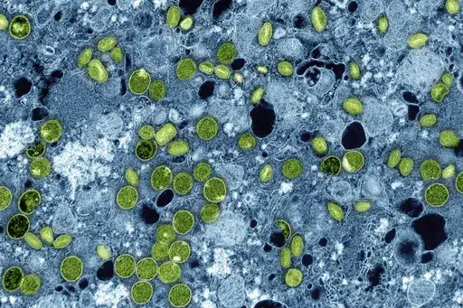 This colorized electron microscope image provided by the National Institute of Allergy and Infectious Diseases in 2024 shows Mpox virus particles, green, found within infected cultured cells, blue. The virus particles are in various stages of maturity, which accounts for differences in shape. (NIAID via AP, File)