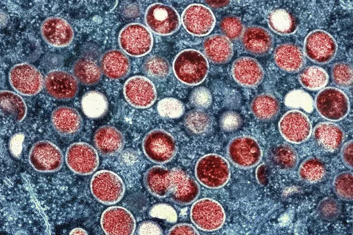 This colorized electron microscope image provided by the National Institute of Allergy and Infectious Diseases shows mpox particles, red, found within an infected cell, blue, cultured in a laboratory in Fort Detrick, Md. A study released by the U.S. Centers for Disease Control and Prevention on Thursday, May 25, 2023, suggests dozens of U.S. cities are at risk for mpox outbreaks this summer. Health officials say they are working to prevent the scale of infections that surprised the nation the pr